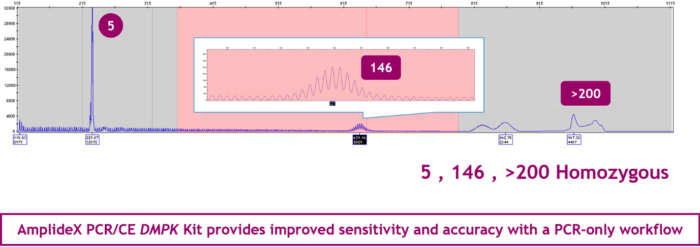dmpk expansions up to 200 repeats